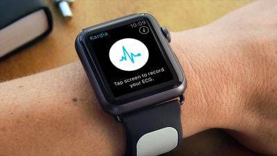 Apple 将面临 Apple Watch 禁止第三方心率应用功能的声明