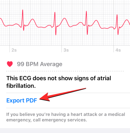 ecg-reading-on-iphone-12-a