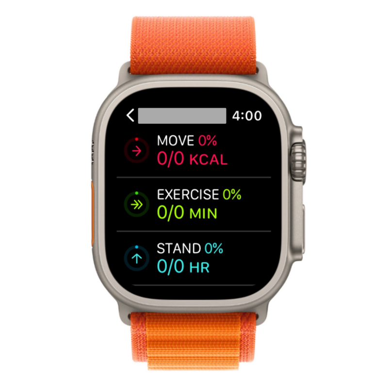 在 Apple Watch 上分享健身：分步教程