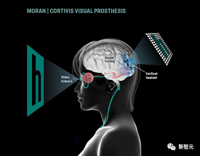 VR的终极形态是「假眼」？Neuralink前联合创始人掏出新产品：科学之眼！