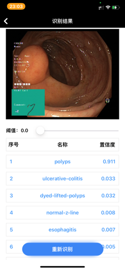 #物联网征文#基于SMA线圈驱动的仿尺蠖肠胃诊察机器人-开源基础软件社区