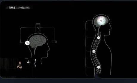马斯克的脑机接口获批人体实验:人造人要来了?