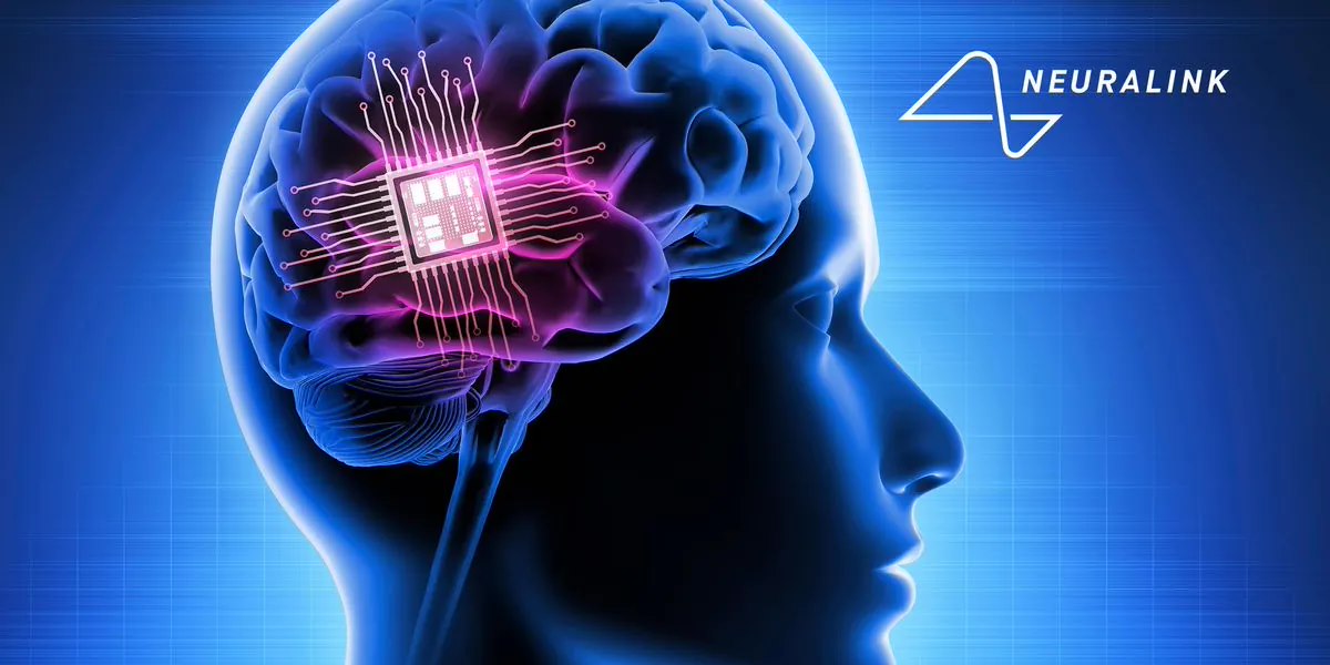 美国 FDA 称马斯克旗下 Neuralink 动物实验存在问题