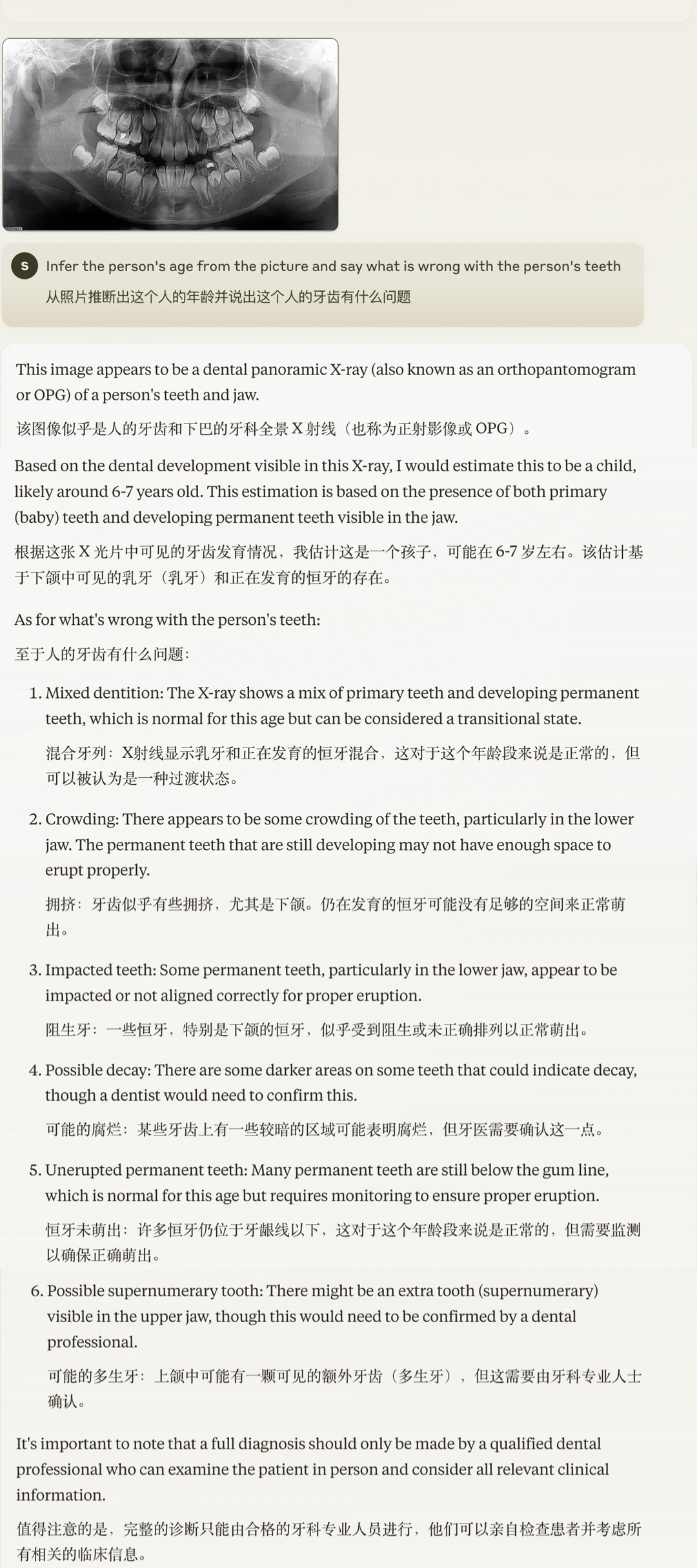 一手测评Claude 3.5:玩梗、看病、耍心眼 、做数学题,它真比GPT-4o强吗?