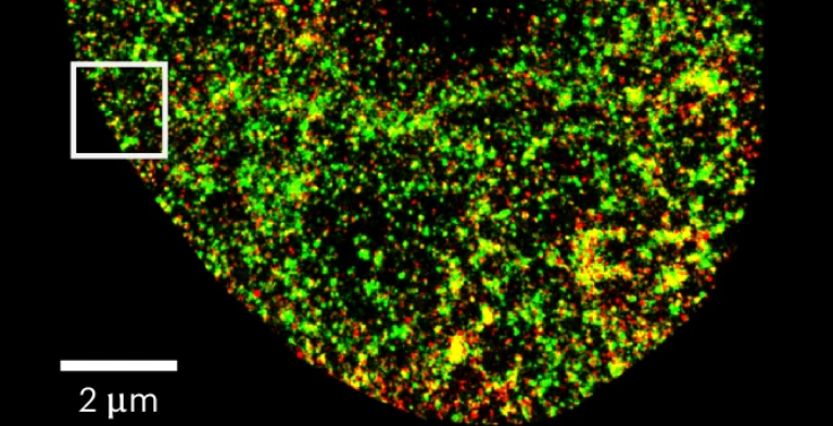 纳米级精度,病毒感染1h内即可检测到,南方医科大学细胞核AI工具登Nature子刊