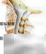 晒太阳能防颈椎病？科学解析真相