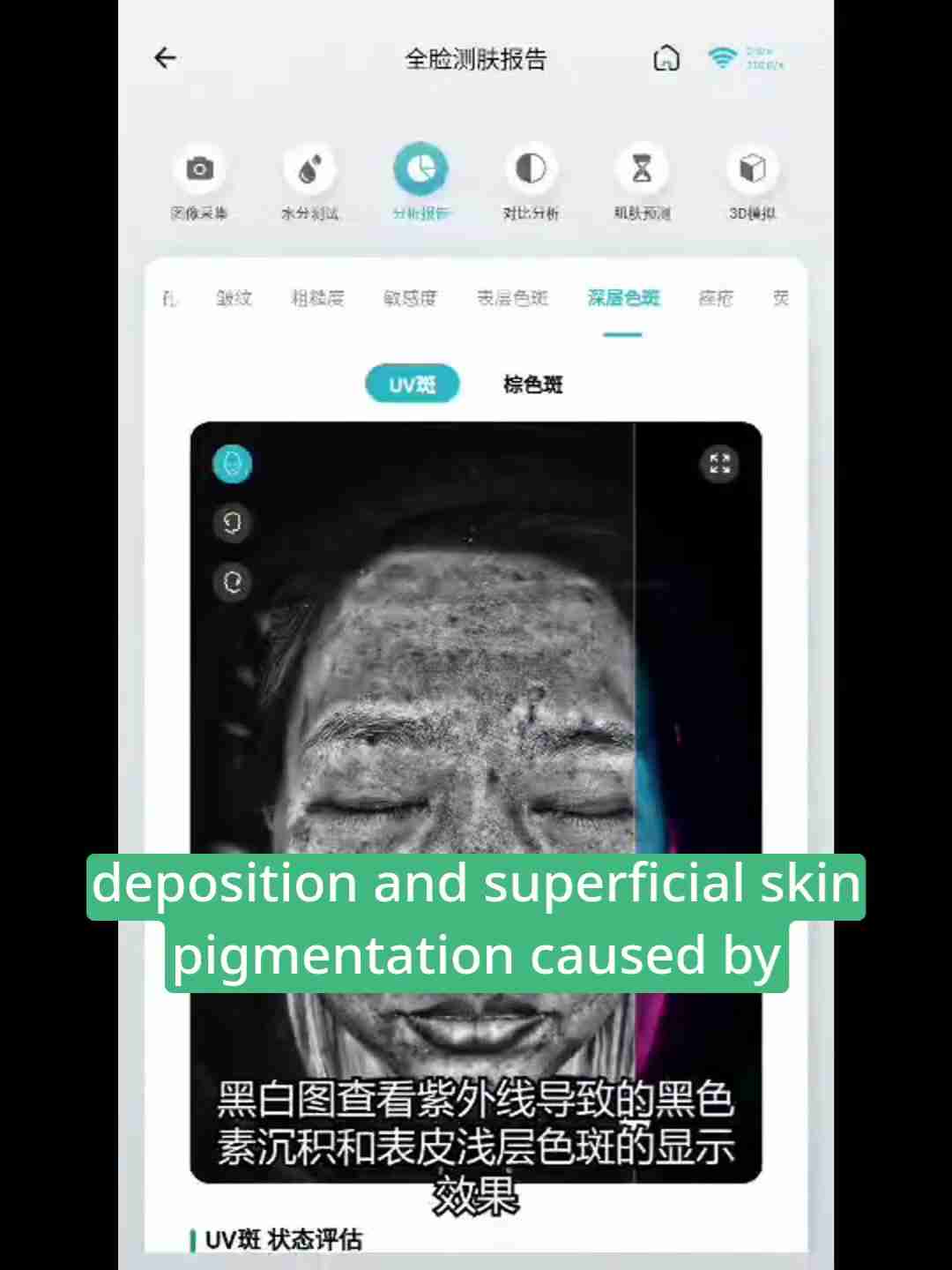 皮肤检测报告解读：深层分析与护理建议