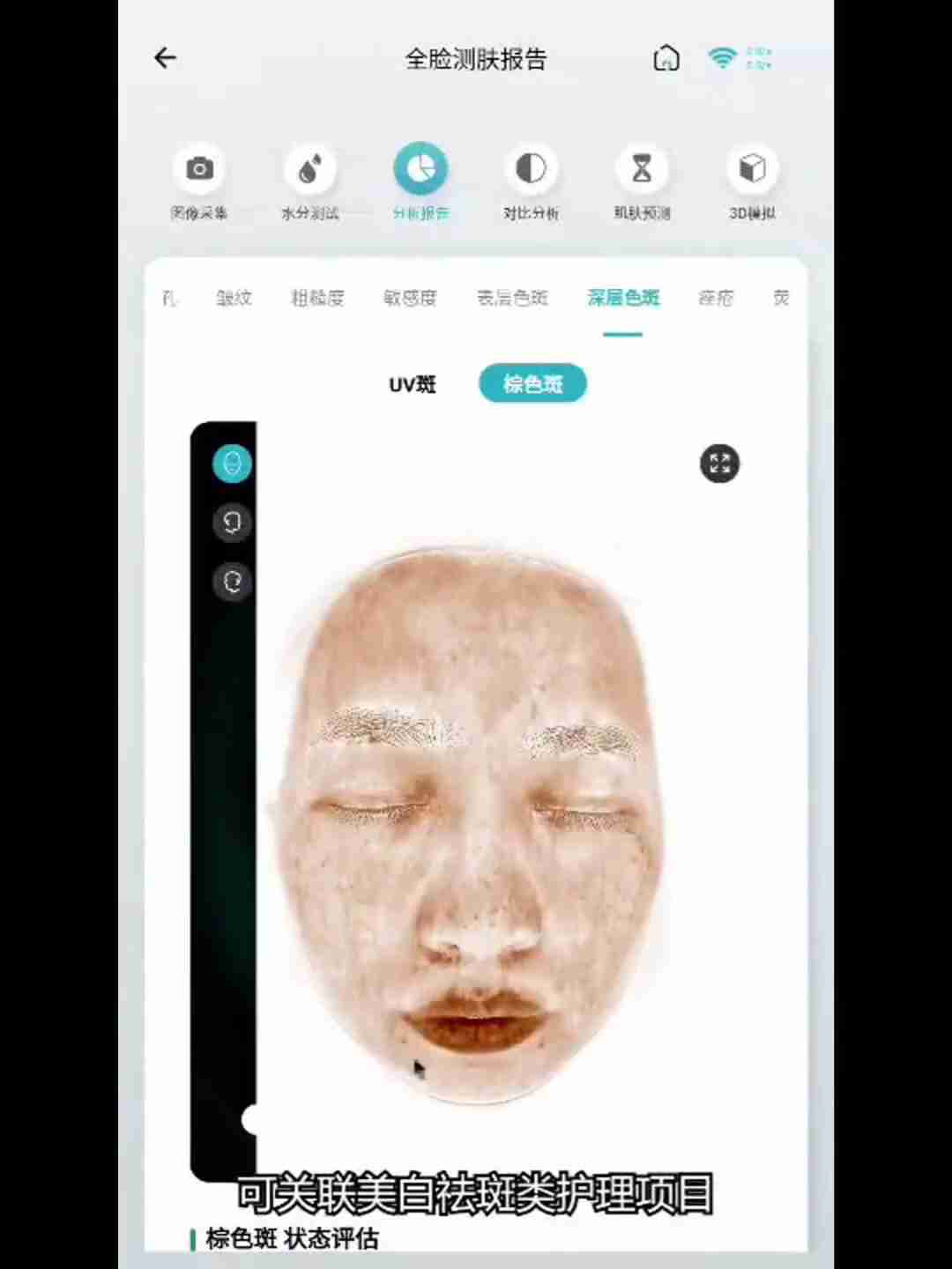 皮肤检测报告解读：深层分析与护理建议