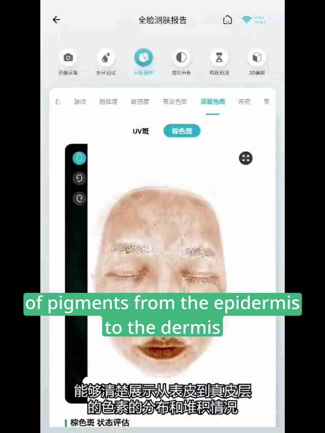 皮肤检测报告解读：深层分析与护理建议