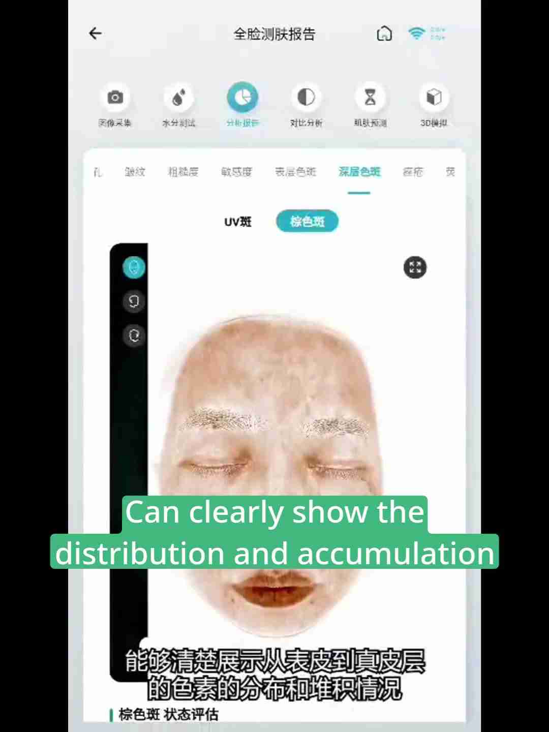 皮肤检测报告解读：深层分析与护理建议