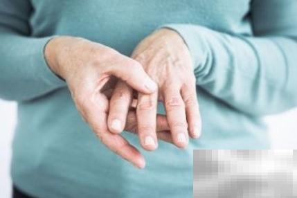 痛风高发人群与预防技巧