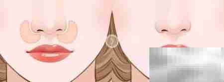 鼻基底恢复自然小技巧