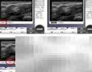 Ultra Skin系统使用指南