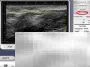 Ultra Skin系统使用指南