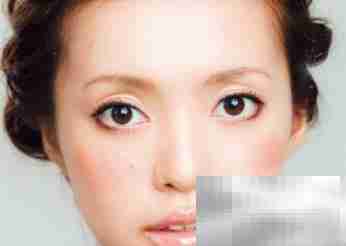 快速去眼袋,重焕明亮双眸