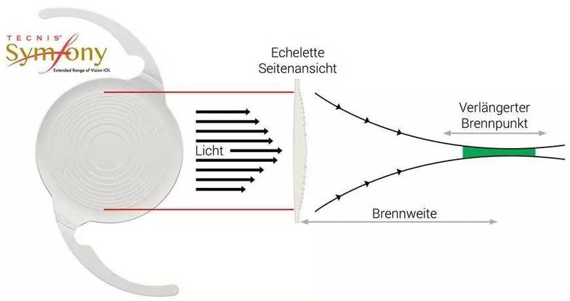 Doctrine结果集转数组的实用方法